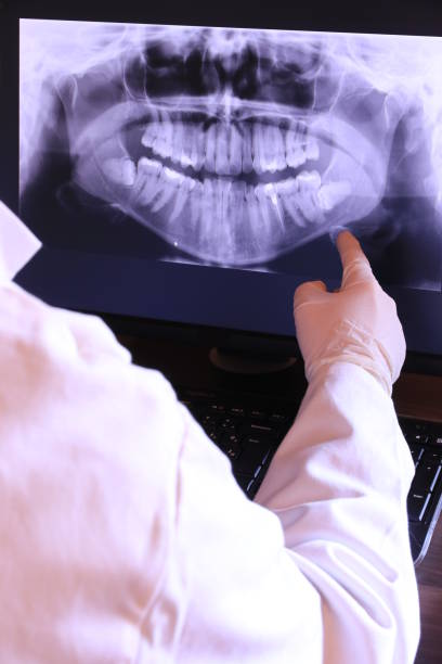 Best Emergency Root Canal Treatment in Mountain Iron, MN
