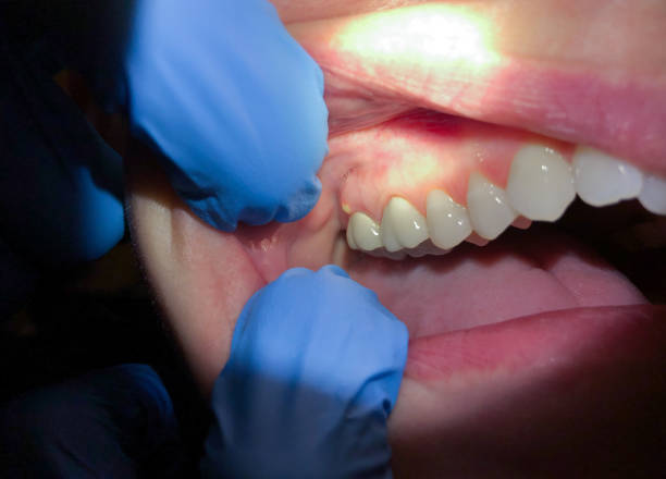 Best Emergency TMJ Treatment in Mountain Iron, MN