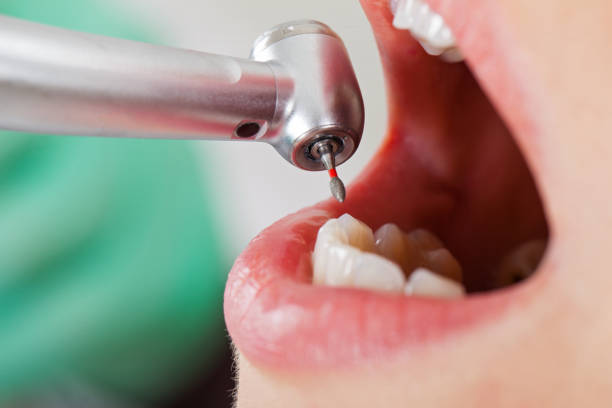 Best Emergency Treatment for Dental Infections or Abscesses in Mountain Iron, MN